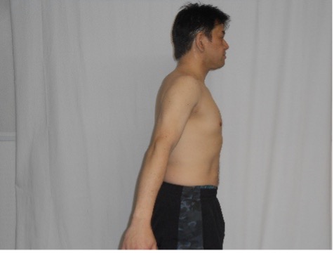 ダイエット事例1After