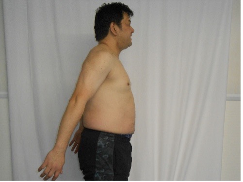ダイエット事例1Before